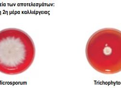 Dermatophyte Uranotest